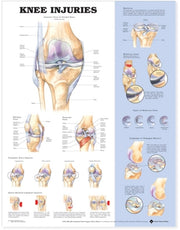 Knee Injuries