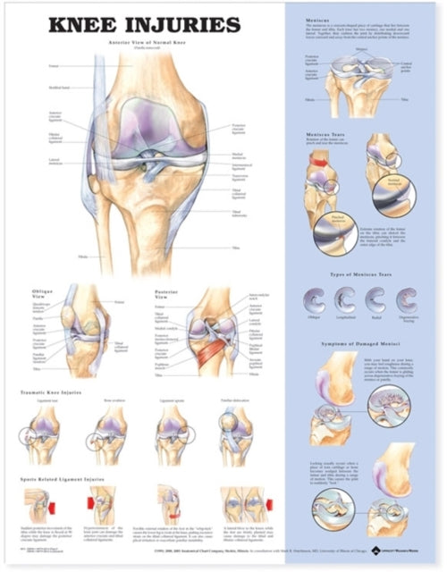 Knee Injuries