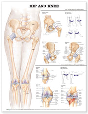 Hip & Knee Laminated