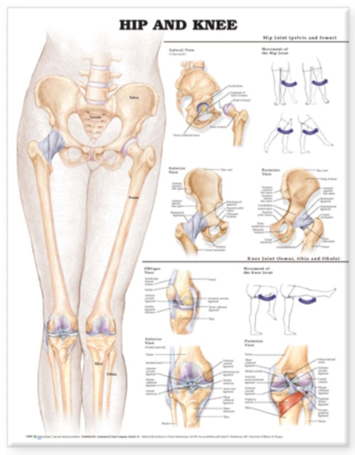 Hip & Knee Laminated