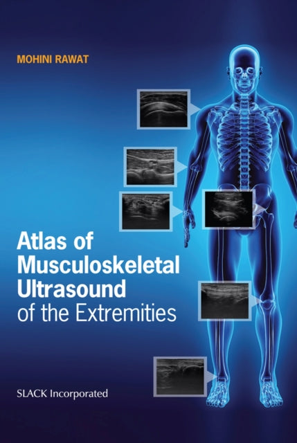 Atlas Of Musculoskeletal Ultrasound Of T