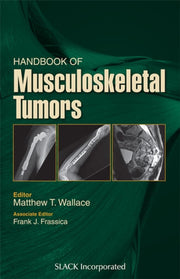 Handbook Of Musculoskeletal Tumors