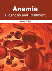 Anemia: Diagnosis And Treatment
