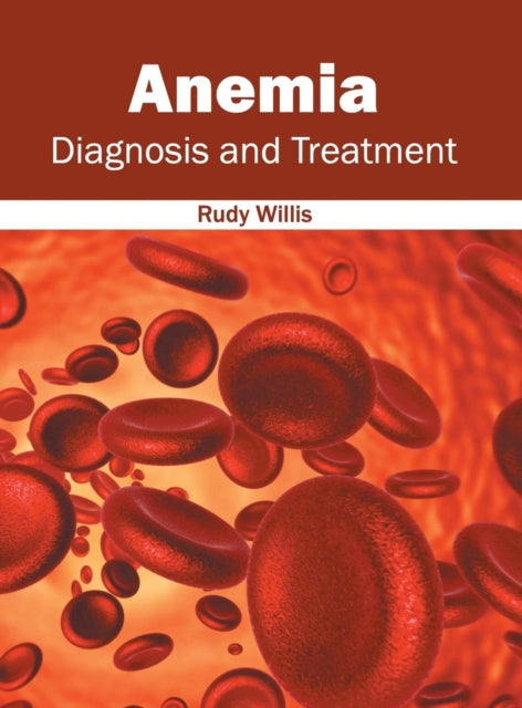 Anemia: Diagnosis And Treatment