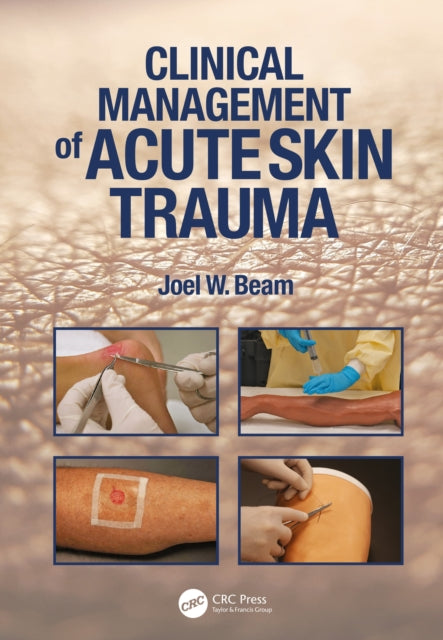 Clinical Management Of Acute Skin Traum By Beam  Joel W.