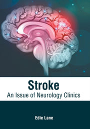 Stroke: An Issue Of Neurology Clinics