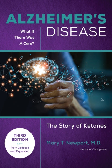 Alzheimers Disease What If There Is A