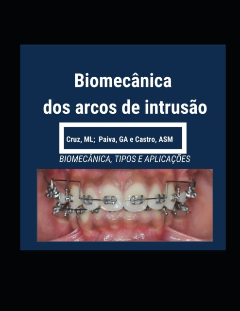 Biomec Nica Dos Arcos De Intrus O