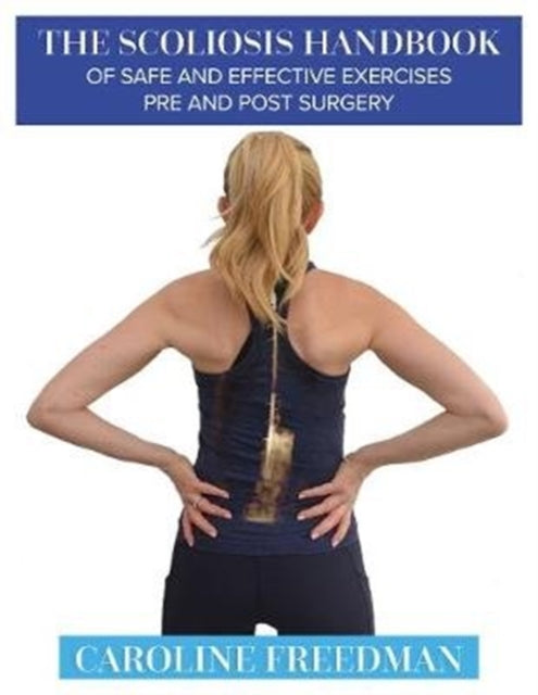 Scoliosis Handbook