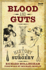 Blood & Guts A History Of Surgery
