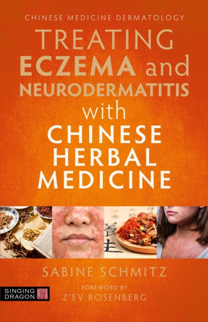 Treating Eczema & Neurodermatitis With