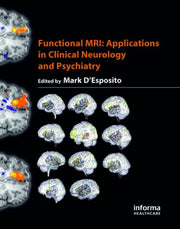 Functional Mri