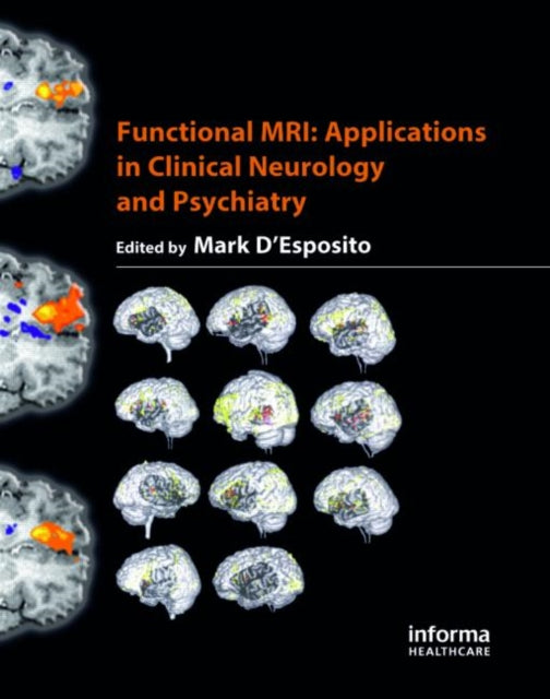 Functional Mri