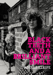 Black Teeth & A Brilliant Smile