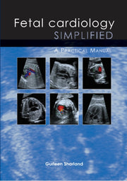 Fetal Cardiology Simplified