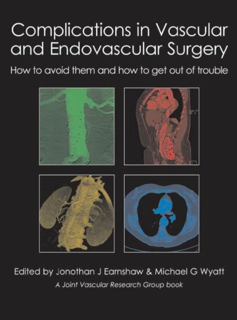 Complications In Vascular & Endovascular