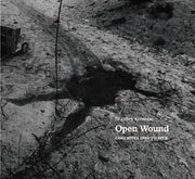 Open Wound