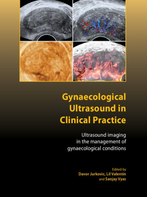 Gynaecologcl Ultrasound Clinic Prac By Edited By Davor Jurk