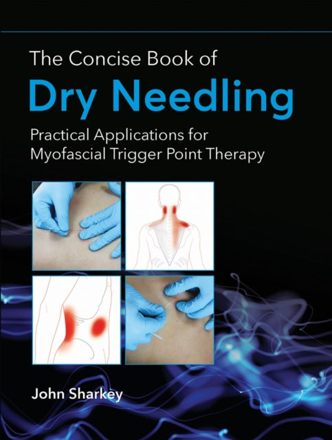 Concise Book Of Dry Needling
