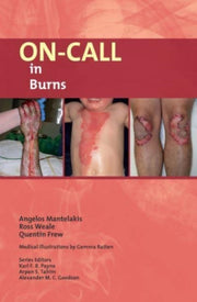 Oncall In Burns