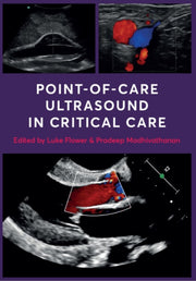 Point Of Care Ultrasound In Critical Ca