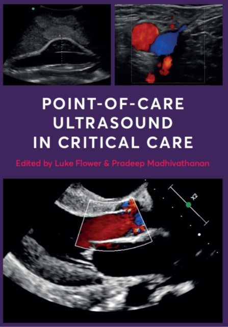 Point Of Care Ultrasound In Critical Ca
