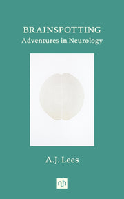 Brainspotting
