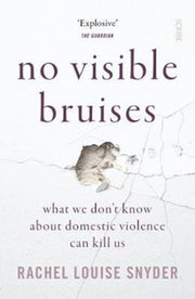 No Visible Bruises