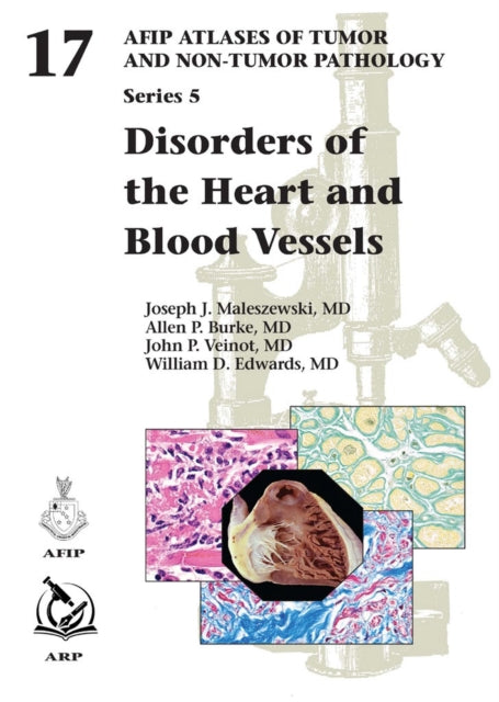 Disorders Of The Heart & Blood Vessels By (author), Joseph
