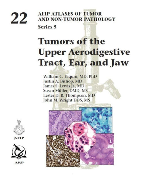 Tumors Of The Upper Aerodigestive Tract By William C. Faquin