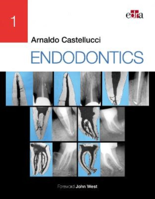 Endodontics 2 Volume Set By Castellucci, Arnaldo