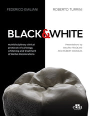 Black White