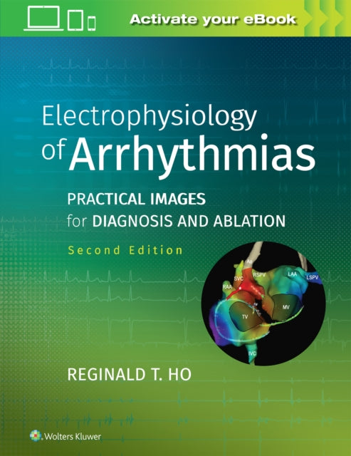 Electrophysiology Of Arrhythmias Practic By Reginald, T Ho