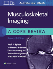 Musculoskeletal Imaging A Core Review 2e