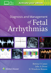 Diagnosis & Management Of Fetal Arrhythm By Cuneo Bettina