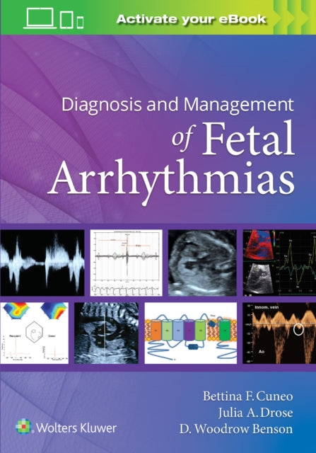 Diagnosis & Management Of Fetal Arrhythm By Cuneo Bettina