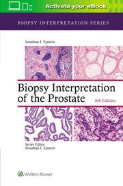 Biopsy Interpretation Of Prostate 6e