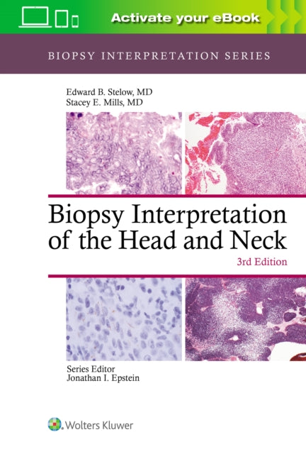 Biopsy Interpretation Of The Head & Neck