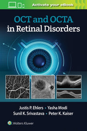 Oct & Oct Angiography In Retinal Disorde