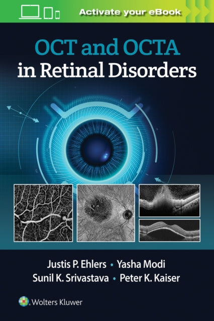 Oct & Oct Angiography In Retinal Disorde