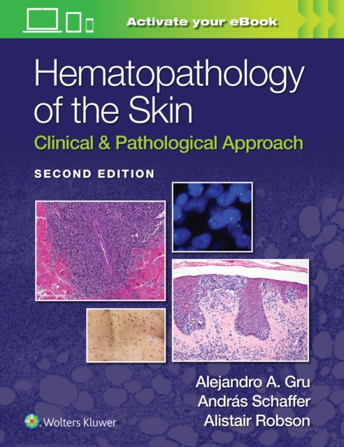 Hematopathology Of The Skin 2e