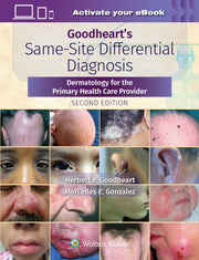 Goodhearts Samesite Differential Diagnos