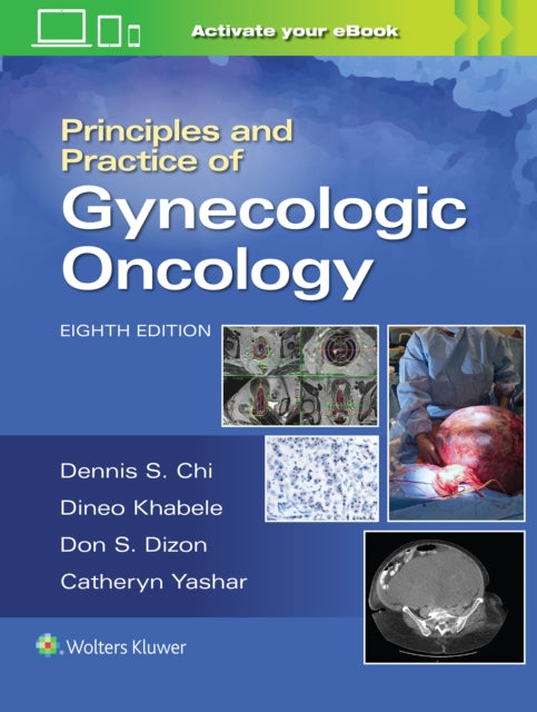 Principles & Practice Of Gynecologic Onc