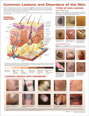 Common Lesions & Disorders Of The Skin