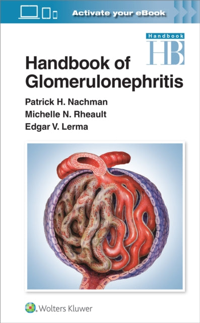 Handbook Of Glomerulonephritis By Nachman, Patrick