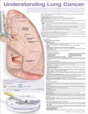 Understanding Lung Cancer Anatomical Cha