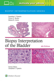 Biopsy Interpretation Bladder 4e By Jonathan I. Epstein