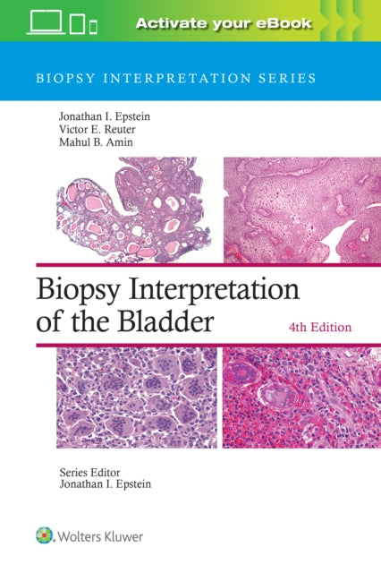 Biopsy Interpretation Bladder 4e By Jonathan I. Epstein
