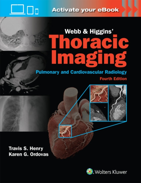 Webb And Higgins Thoracic Imaging Prin