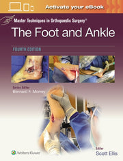 Master Techniques In Orthopaedic Surgery